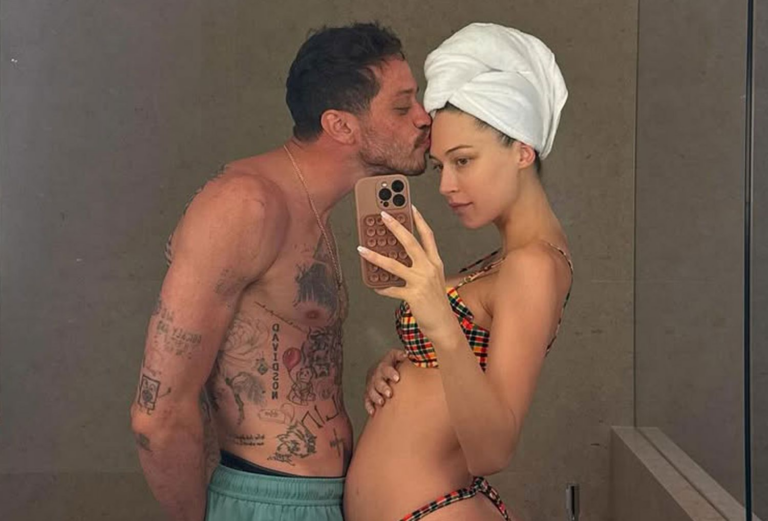 New Shirtless Photo of Pete Davidson Shows the Status of His Tattoo Removal