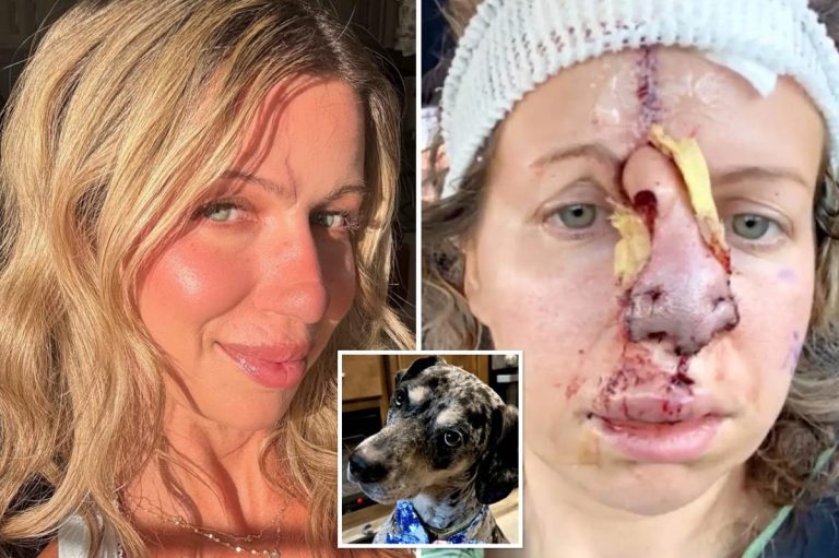 Nevada woman breaks silence after pet dog bites off part of nose